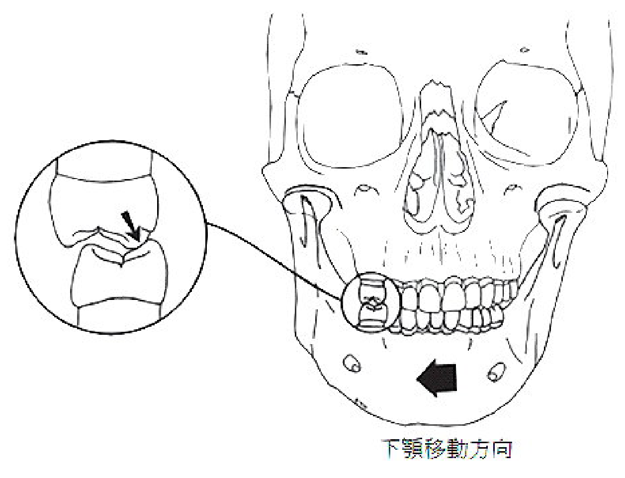 題目附圖