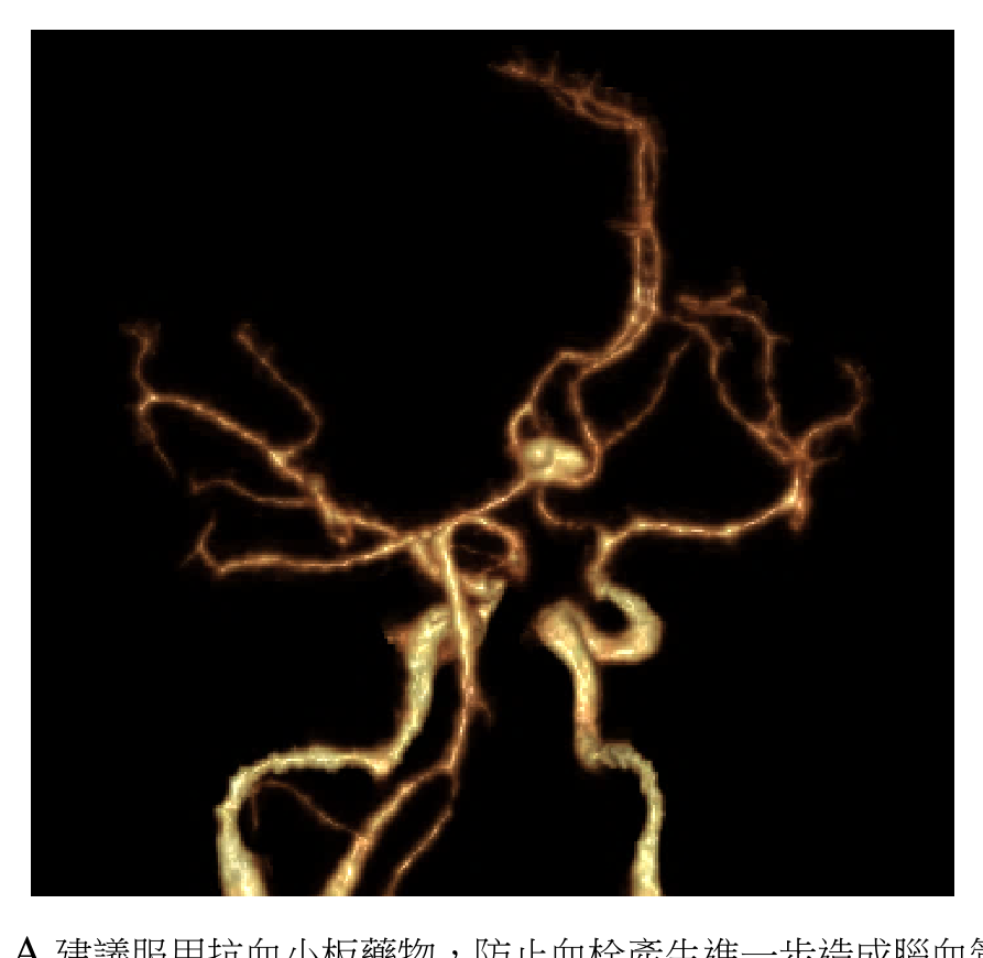題目附圖