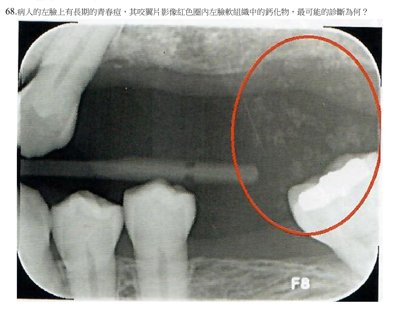題目附圖
