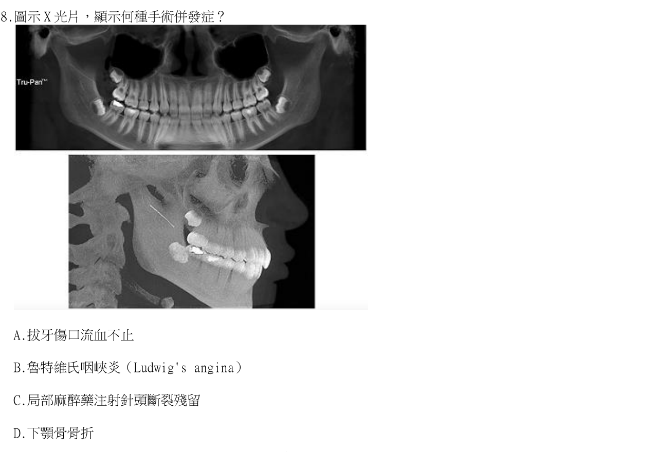題目附圖