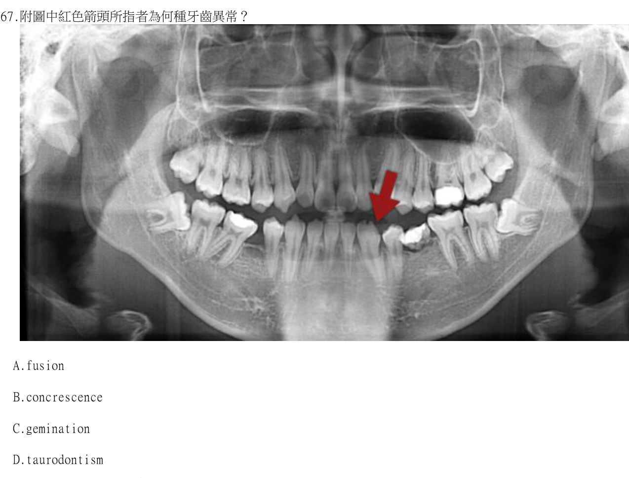 題目附圖
