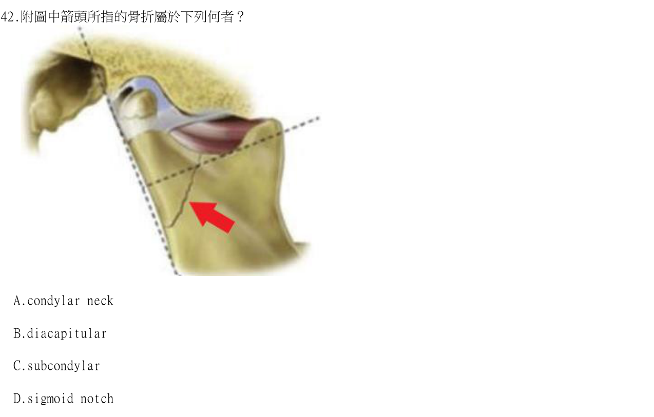題目附圖