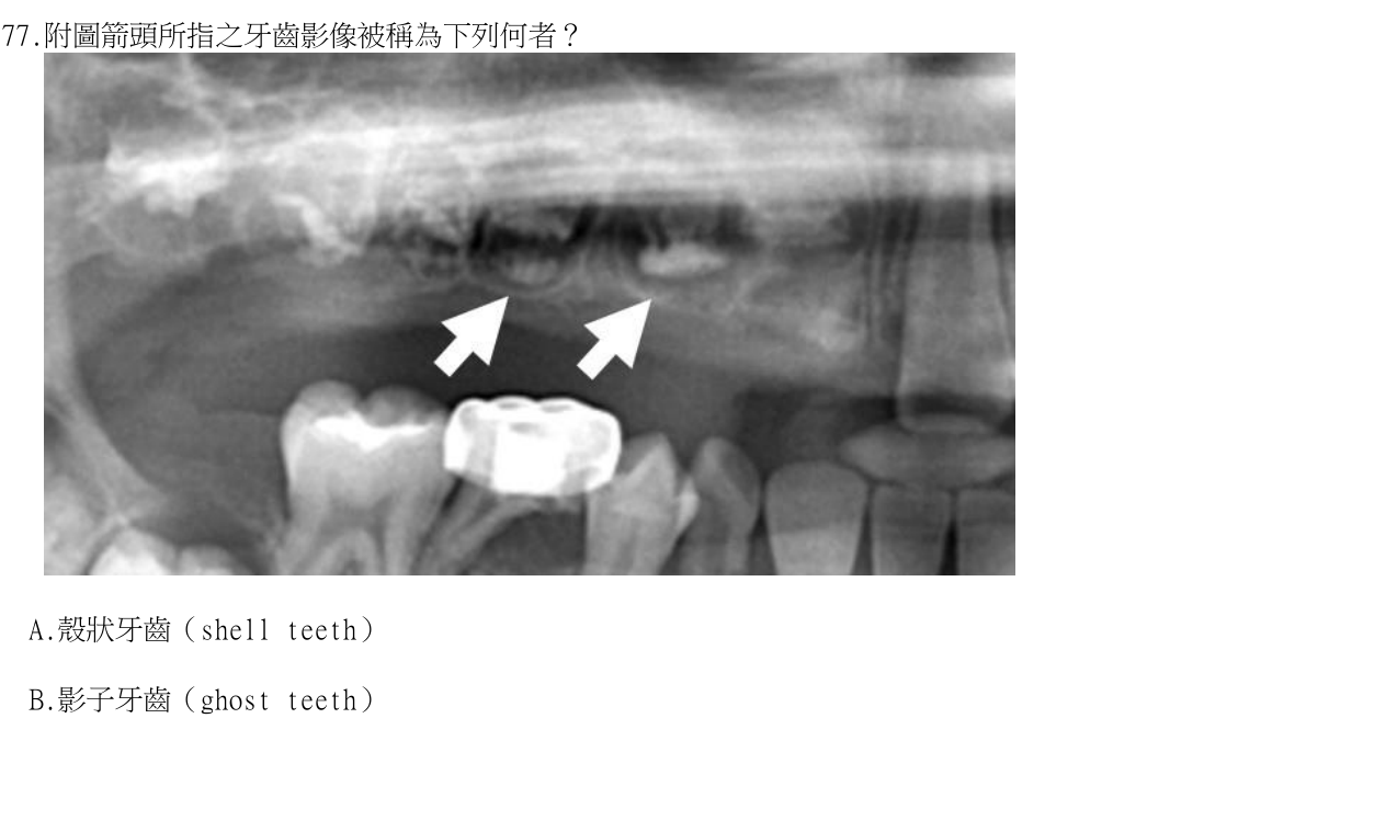 題目附圖