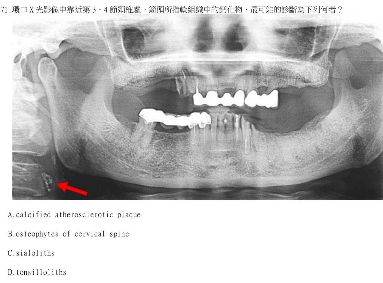 題目附圖