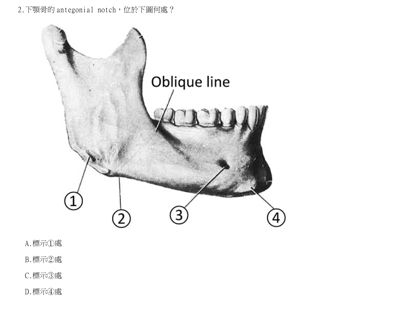 題目附圖
