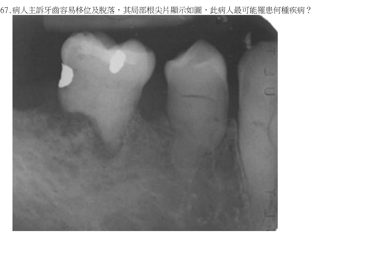 題目附圖