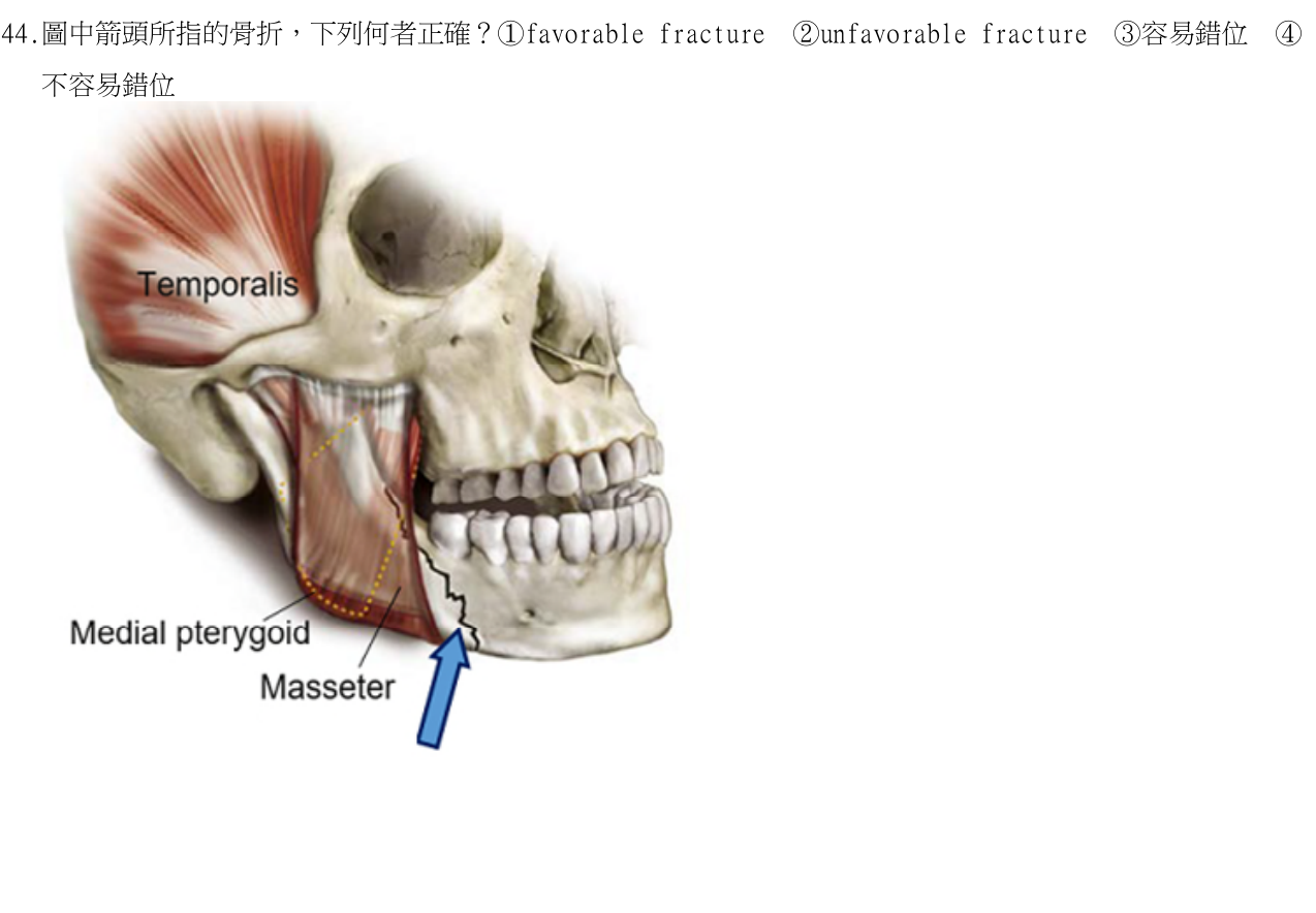 題目附圖