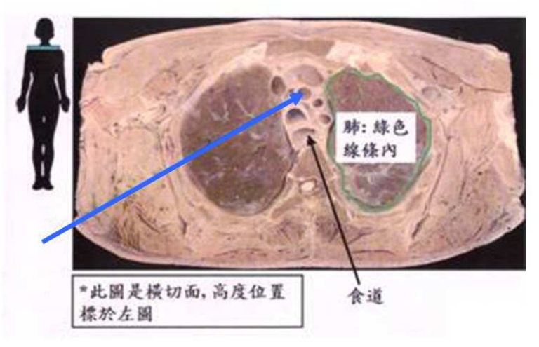 題目附圖