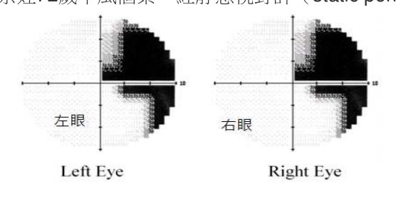 題目附圖