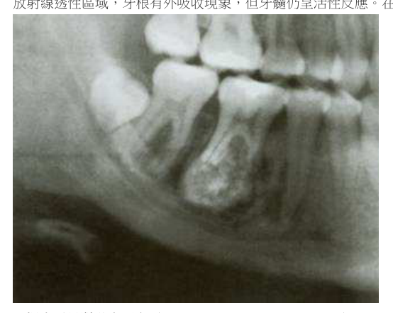 題目附圖
