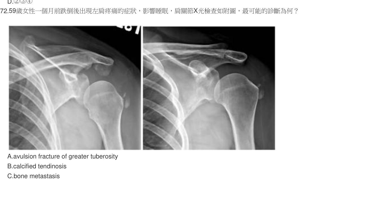 題目附圖