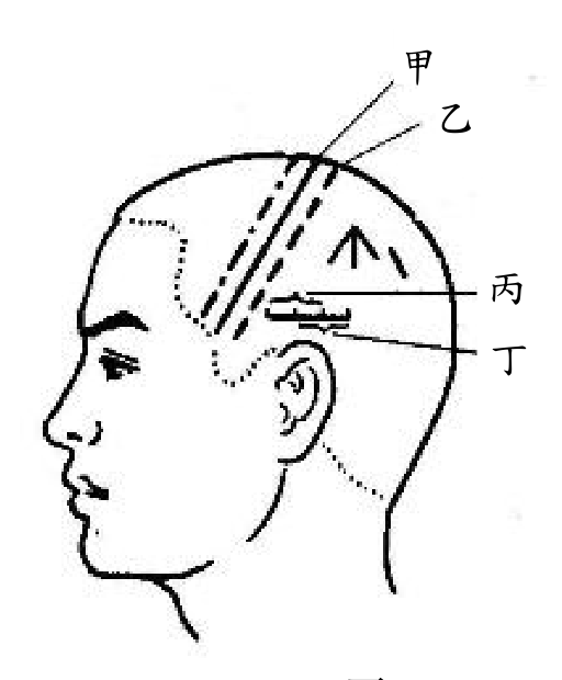 題目附圖