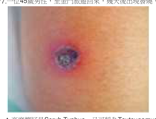 題目附圖