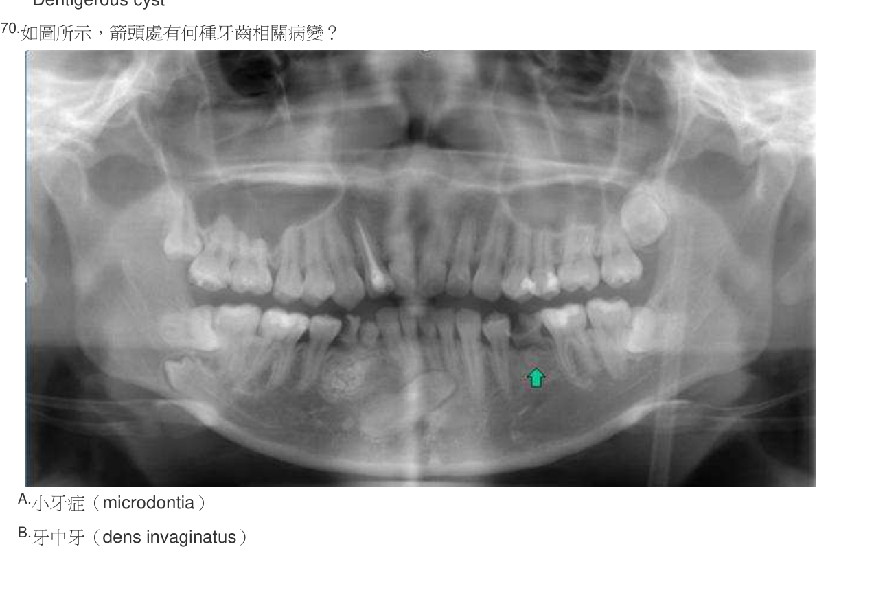題目附圖
