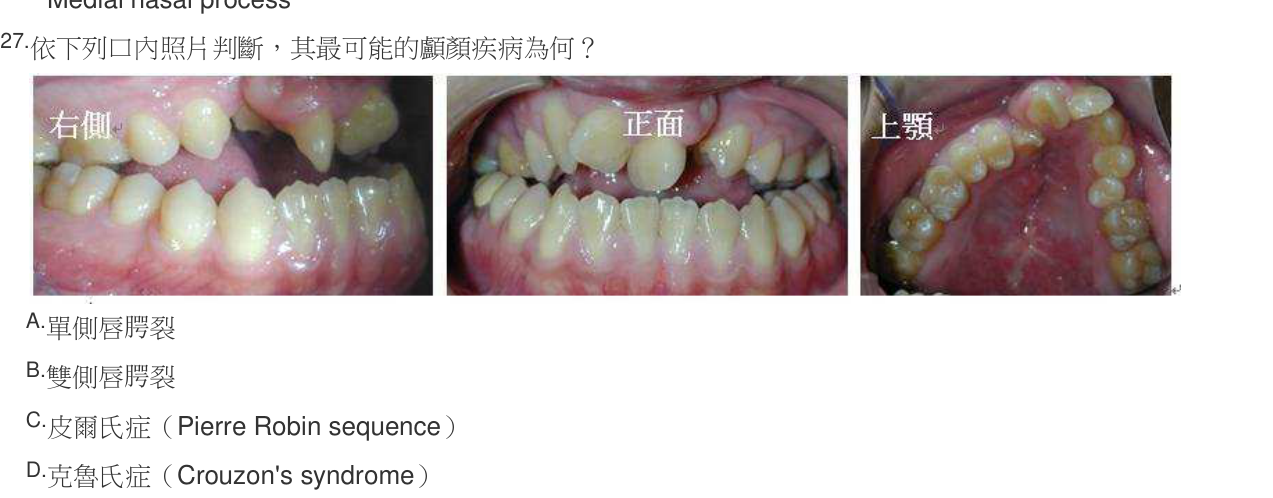 題目附圖
