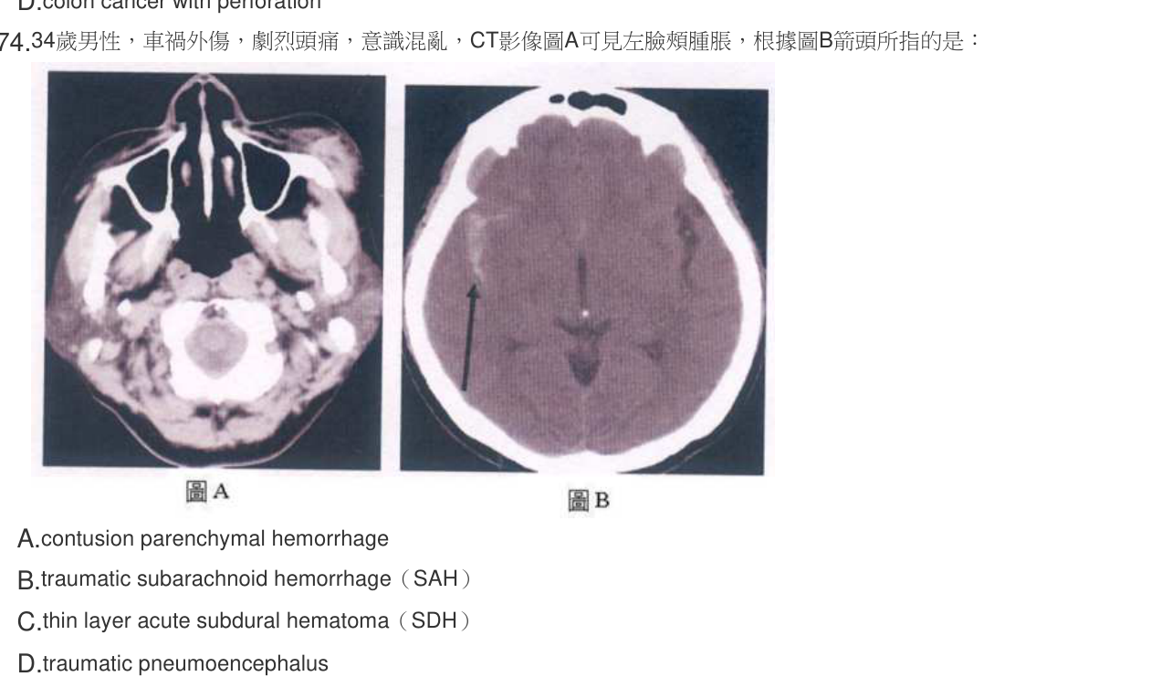 題目附圖