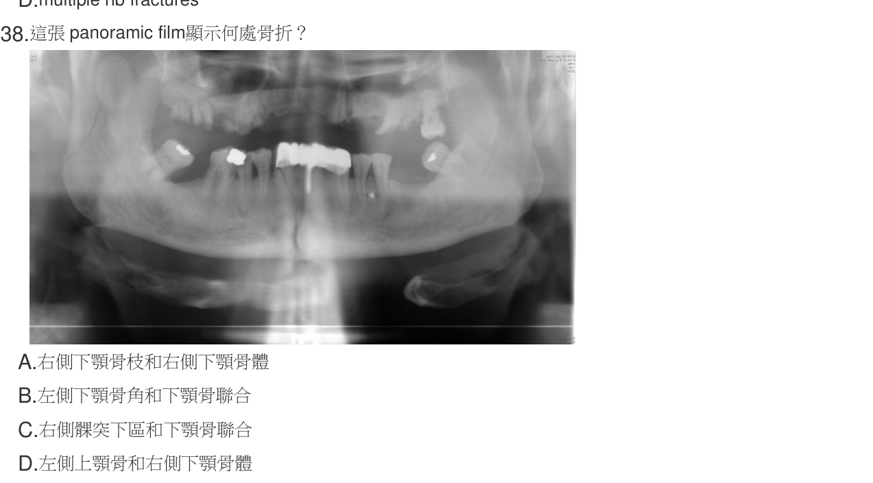 題目附圖