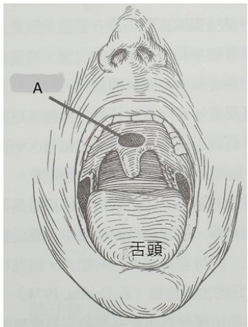 題目圖片