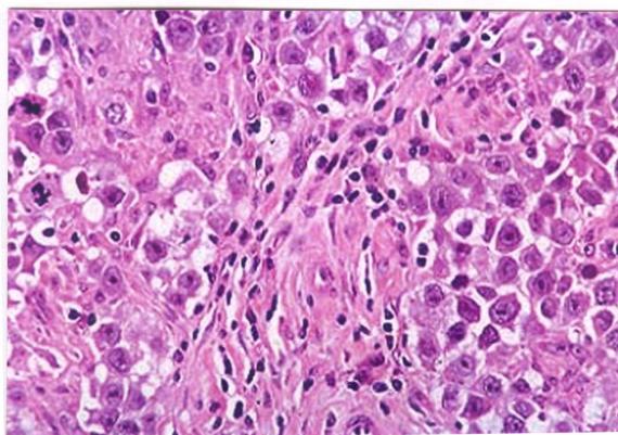 題目圖片