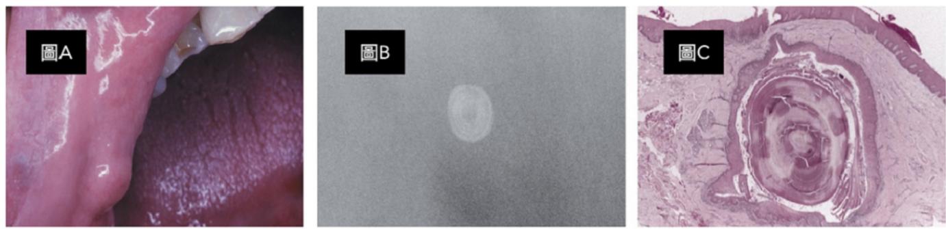 題目圖片