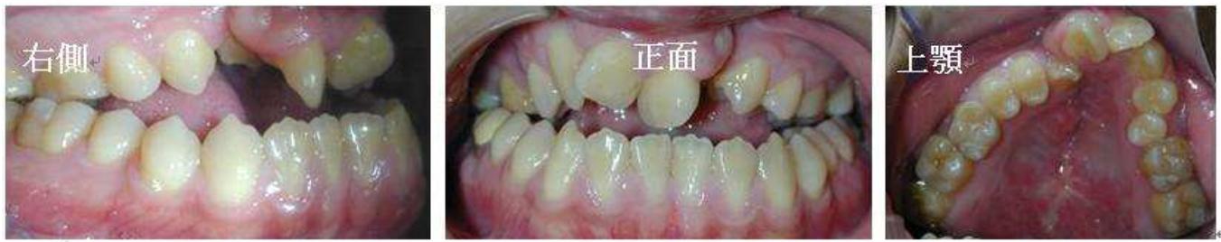題目圖片