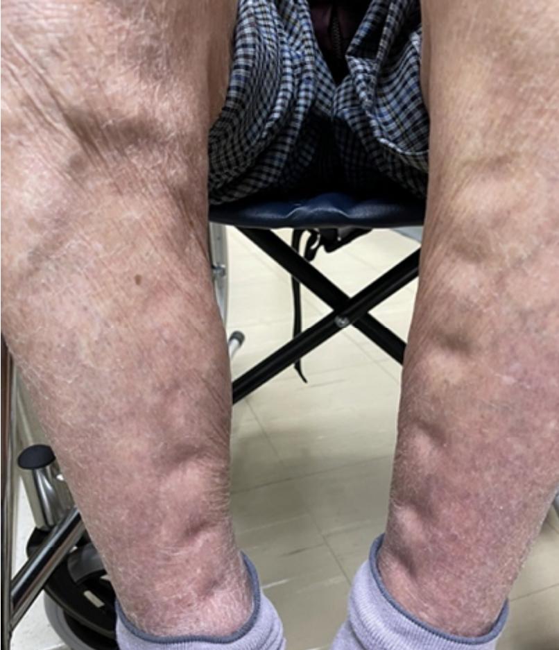 題目圖片