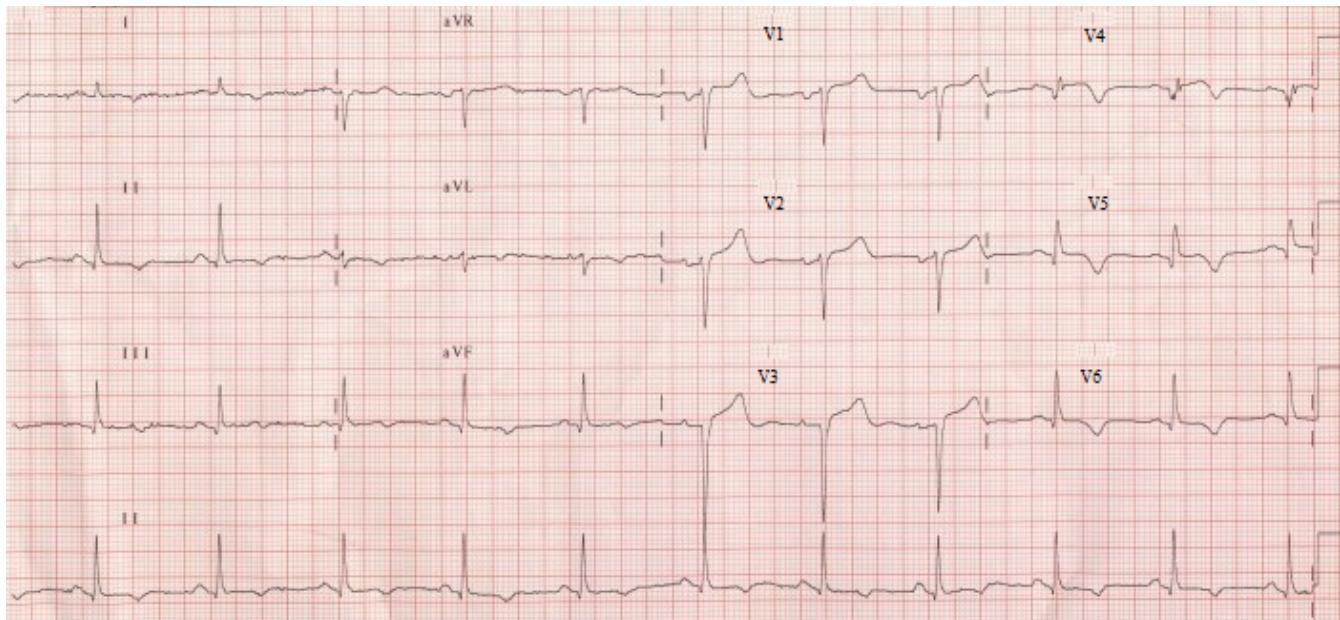 題目圖片